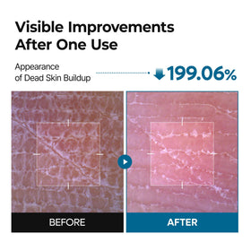 Close-up of Dr.Melaxin Peel Shot Exfoliating Spray nozzle