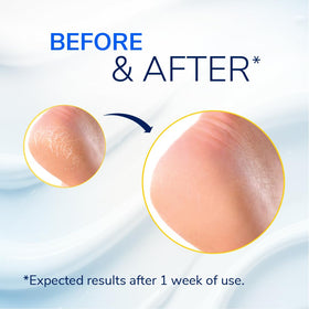 Close-up of Dr. Scholl's Severe Cracked Heel Repair Balm texture