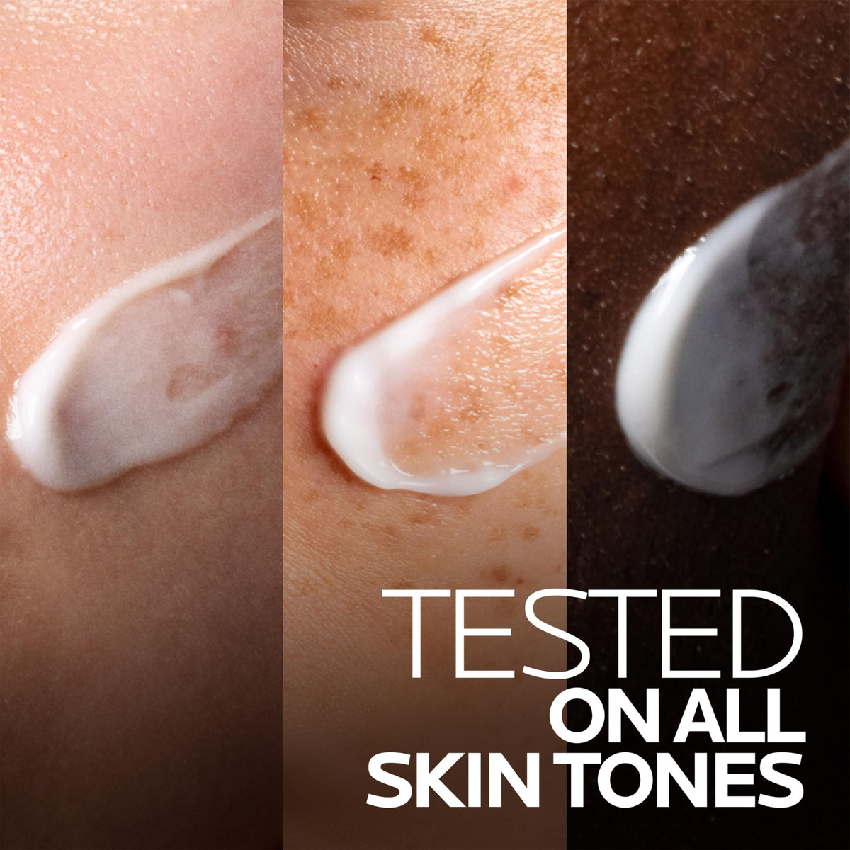 Close-up of Duo+M Cream application on skin