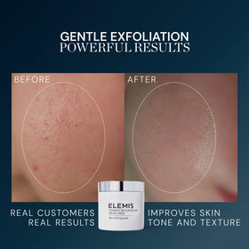Close-up of ELEMIS Dynamic Resurfacing Facial Pad texture