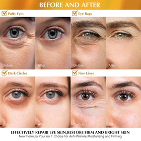 Close-up of Enaskin Naturals 24K Gold Under Eye Patch