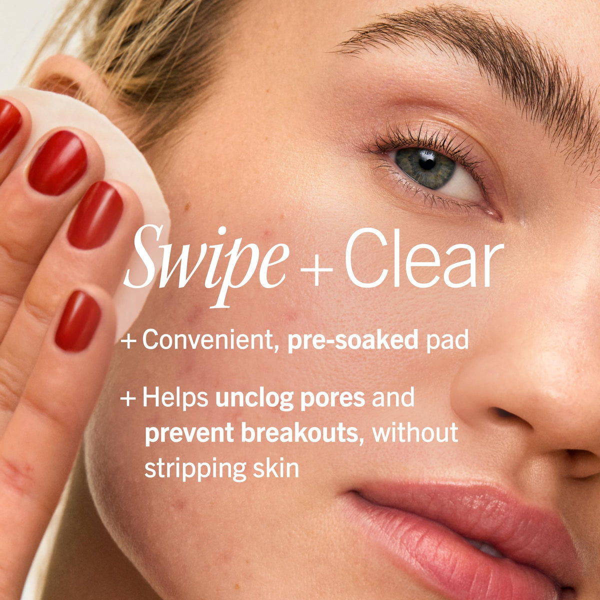 Close-up of First Aid Beauty Acne Pads packaging