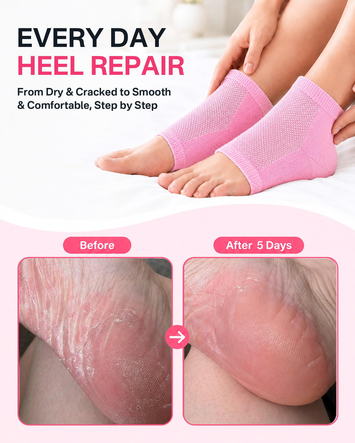 Close-up of gel lining in Originbuty moisturizing socks