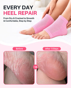 Close-up of gel lining in Originbuty moisturizing socks