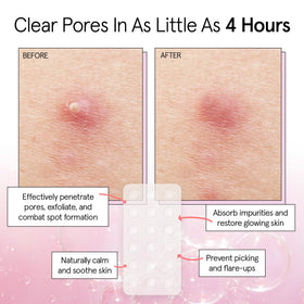 close-up of grace & stella hydrocolloid acne patch on skin