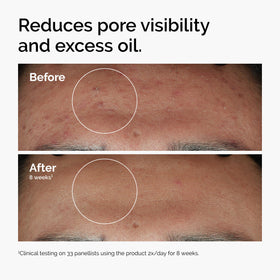 Close-up of Hyaluronic Acid serum texture