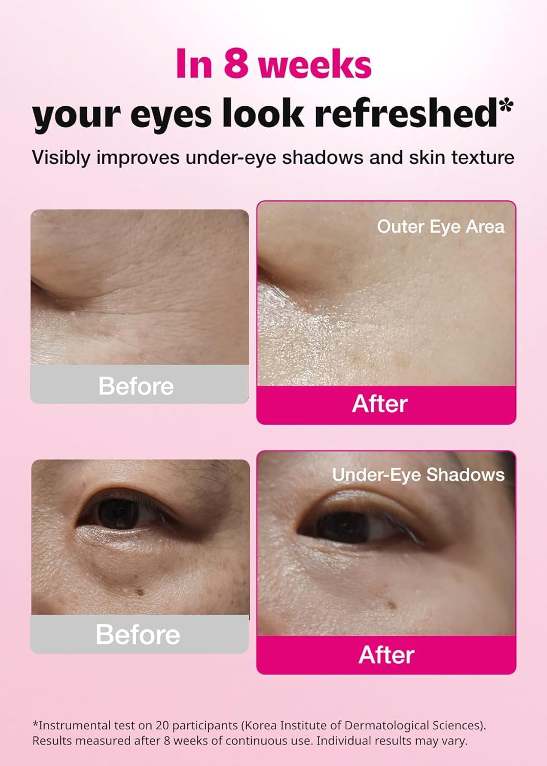 Close-up of ISOI Blemish Care Eye Patch on skin