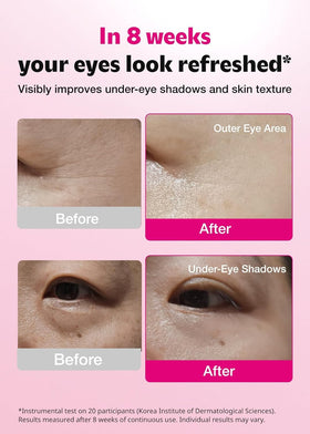 Close-up of ISOI Blemish Care Eye Patch on skin