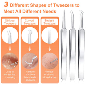 Close-up of IUMAKEVP blackhead extractor tools in silver finish