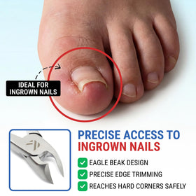 Close-up of KLIPP toenail clippers cutting thick toenails