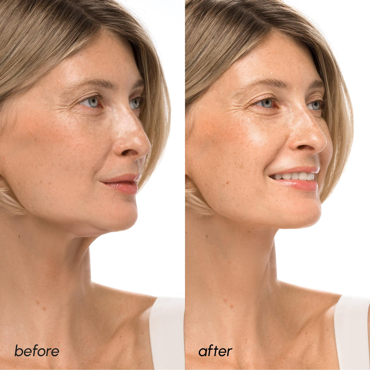 Close-up of MAREE V Line Lifting Mask texture
