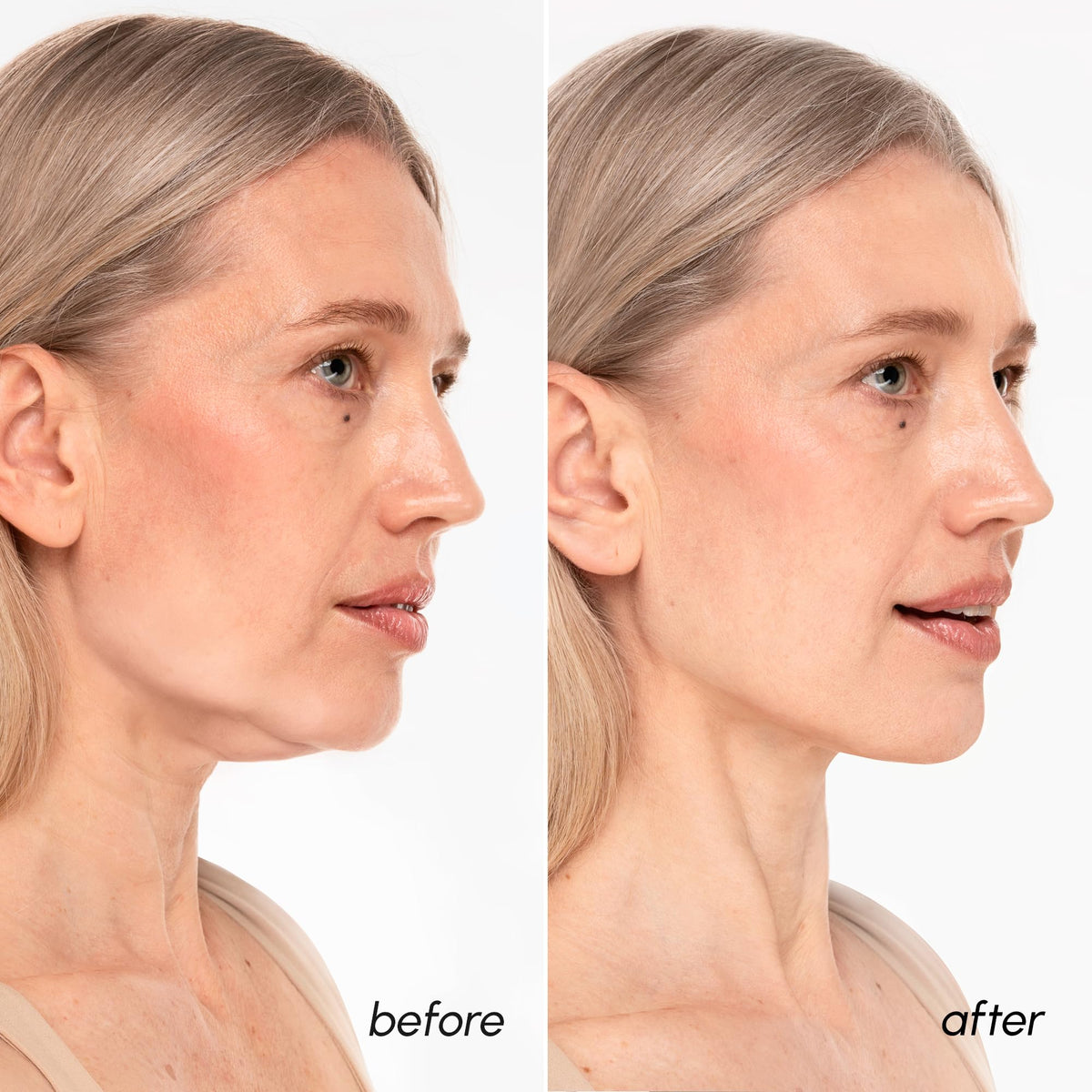 Close-up of MAREE V Line Lifting Mask texture