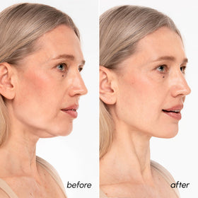 Close-up of MAREE V Line Lifting Mask texture