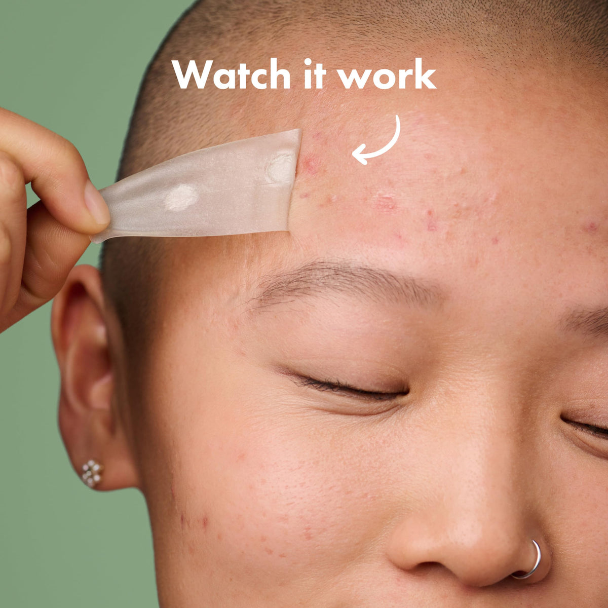 Close-up of Mighty Patch Surface hydrocolloid patch