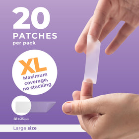 Close-up of PatchRx Large Pimple Patches on skin