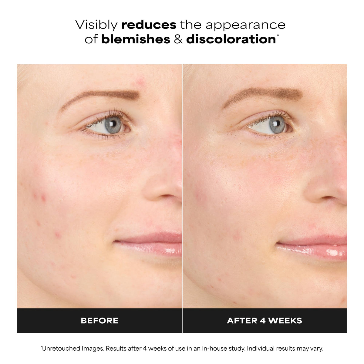 Close-up of Paula's Choice 10% Azelaic Acid support Cream Gel texture