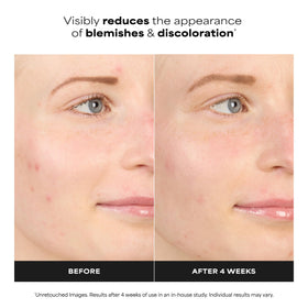 Close-up of Paula's Choice 10% Azelaic Acid support Cream Gel texture