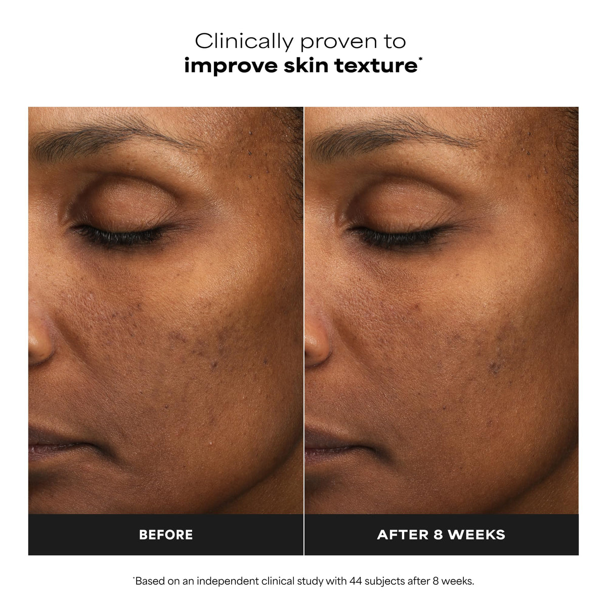Close-up of Paula's Choice exfoliant texture