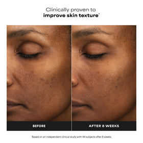 Close-up of Paula's Choice exfoliant texture