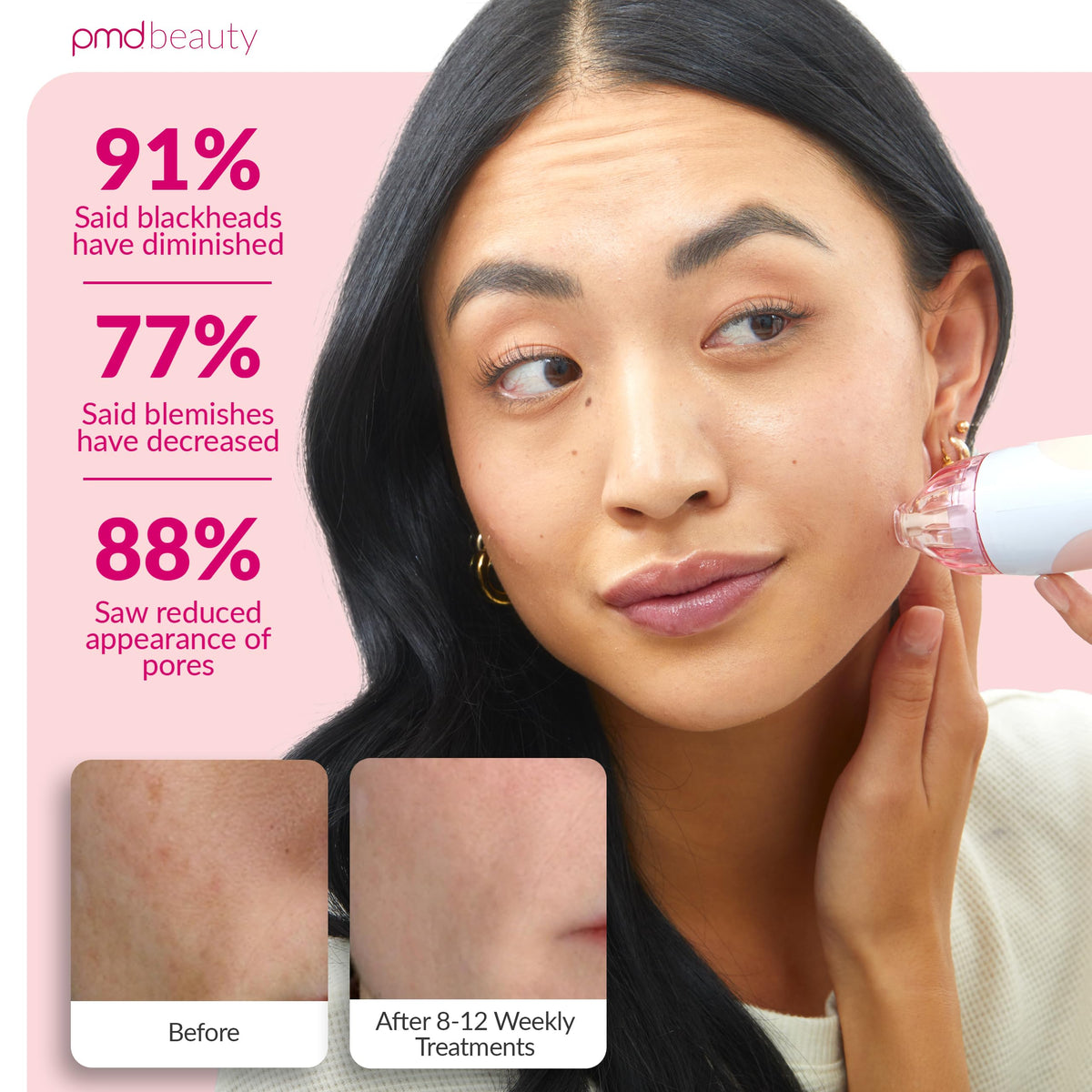 Close-up of PMD Beauty Personal Microderm Classic exfoliation head