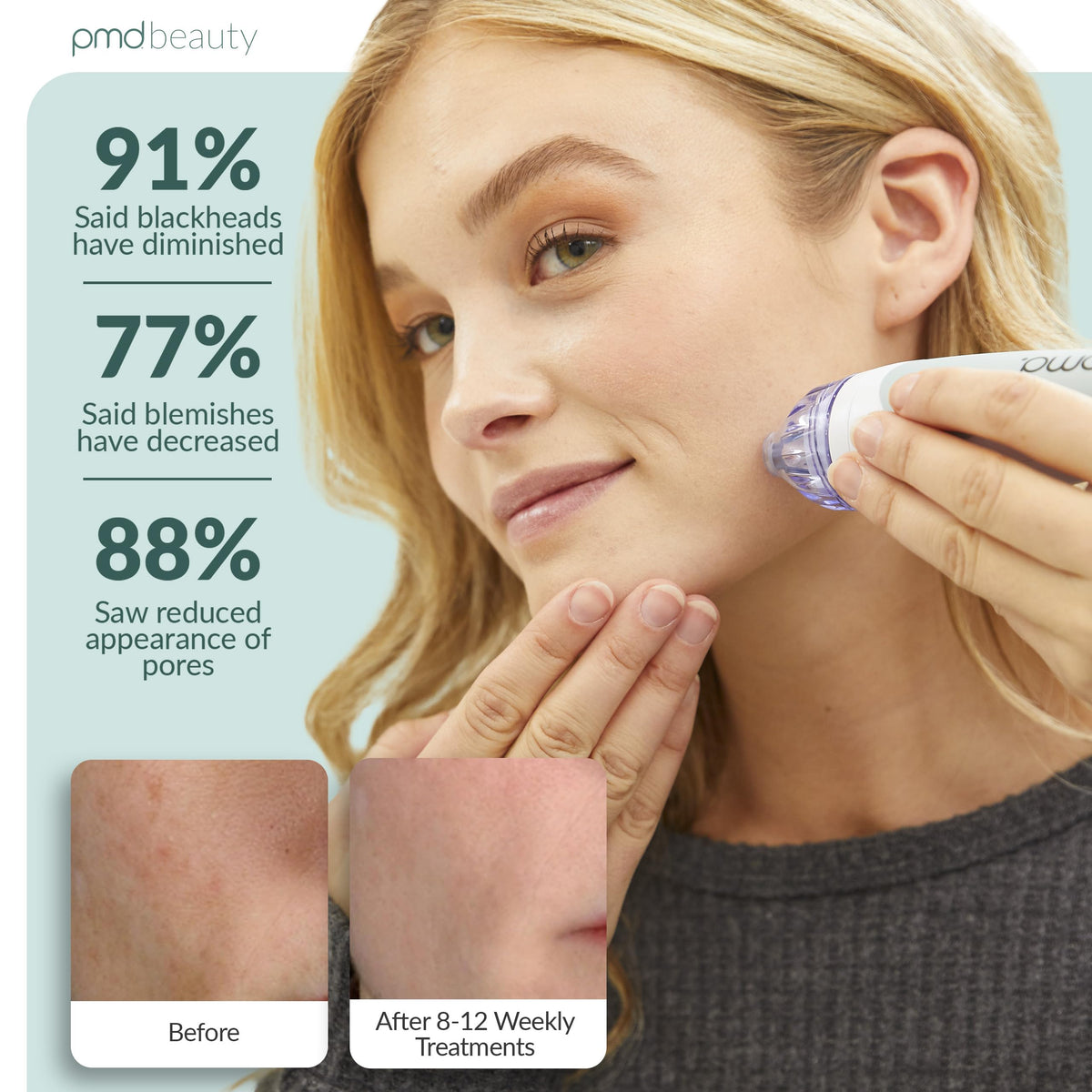 Close-up of PMD Beauty Personal Microderm Classic suction adjustment