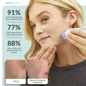 Close-up of PMD Beauty Personal Microderm Classic suction adjustment