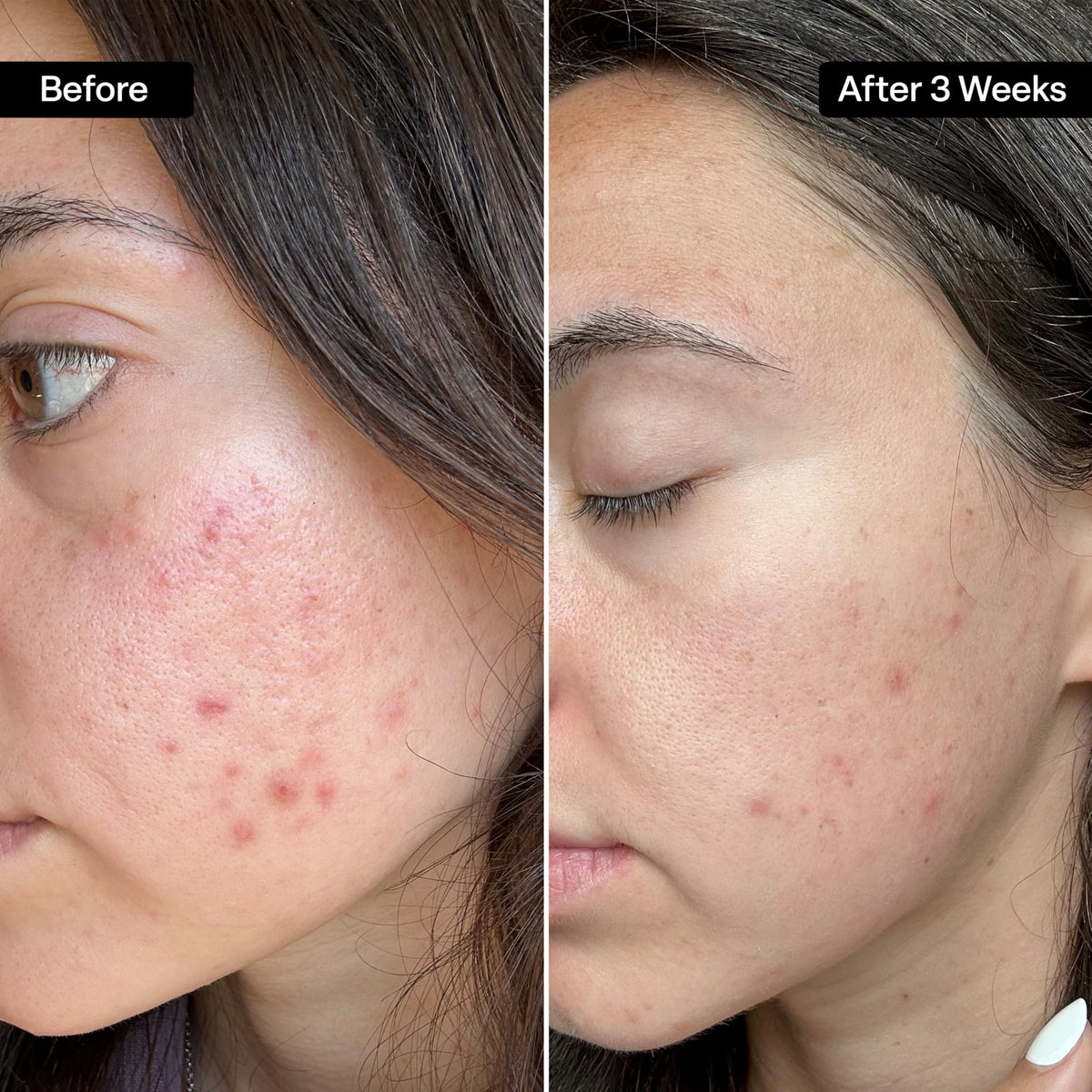Close-up of QRxLabs Salicylic & Glycolic Acid Pad texture