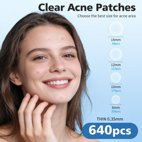 Close-up of QUSTERE Pimple Patches showing various sizes