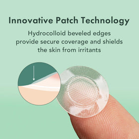 Close-up of Rael pimple patch with microcrystal technology