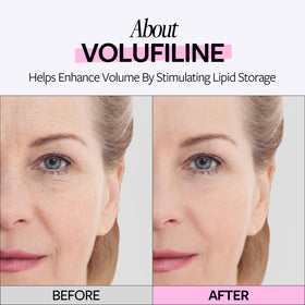 Close-up of RE:CIPE Volufiline 100% Ampoule dropper