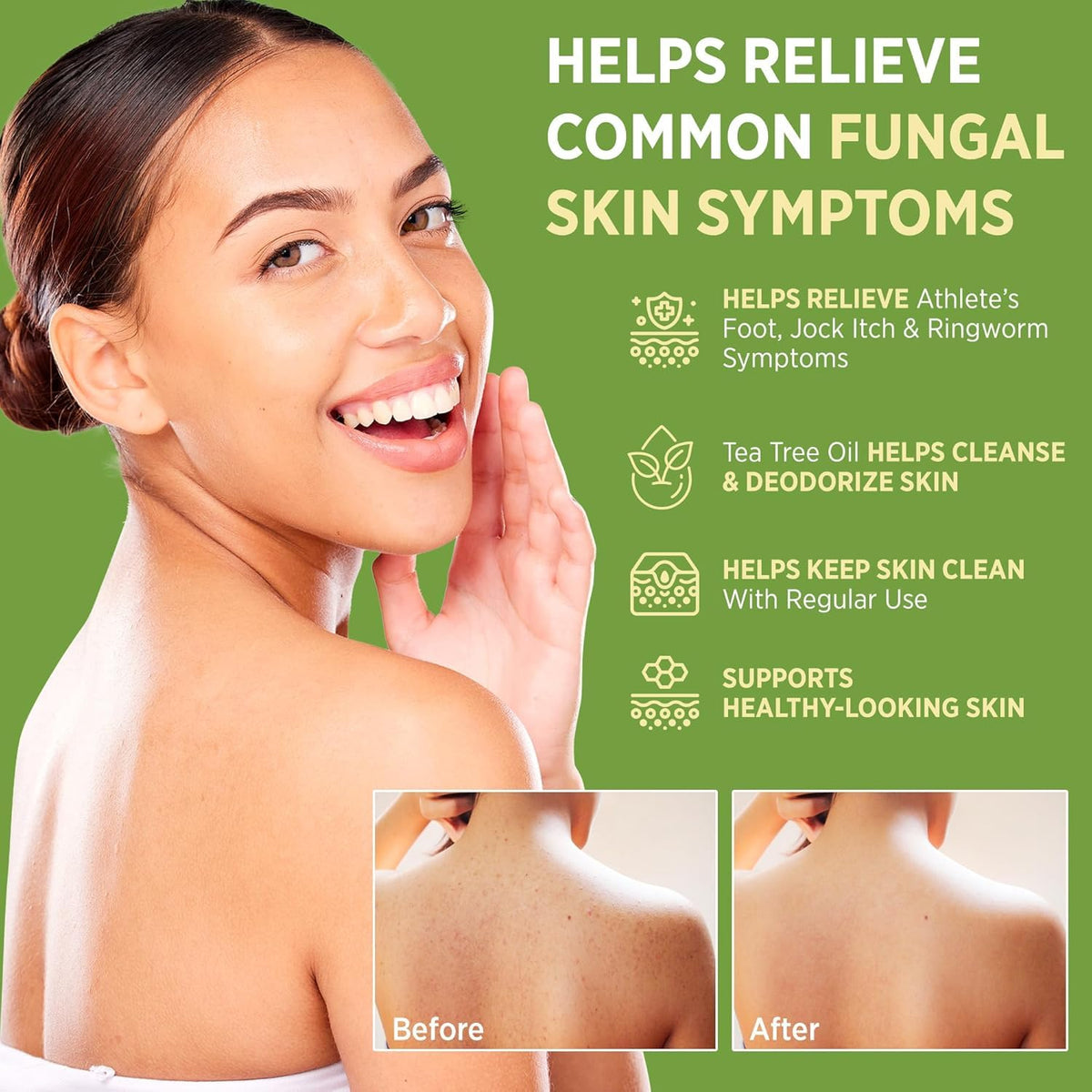 Close-up of Roycederm Antifungal Bar Soap texture