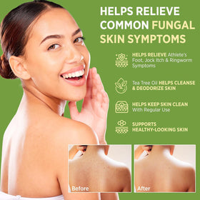 Close-up of Roycederm Antifungal Bar Soap texture