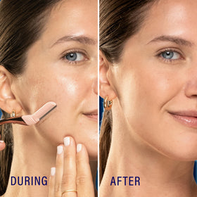 Close-up of Schick Hydro Silk Dermaplaning blades