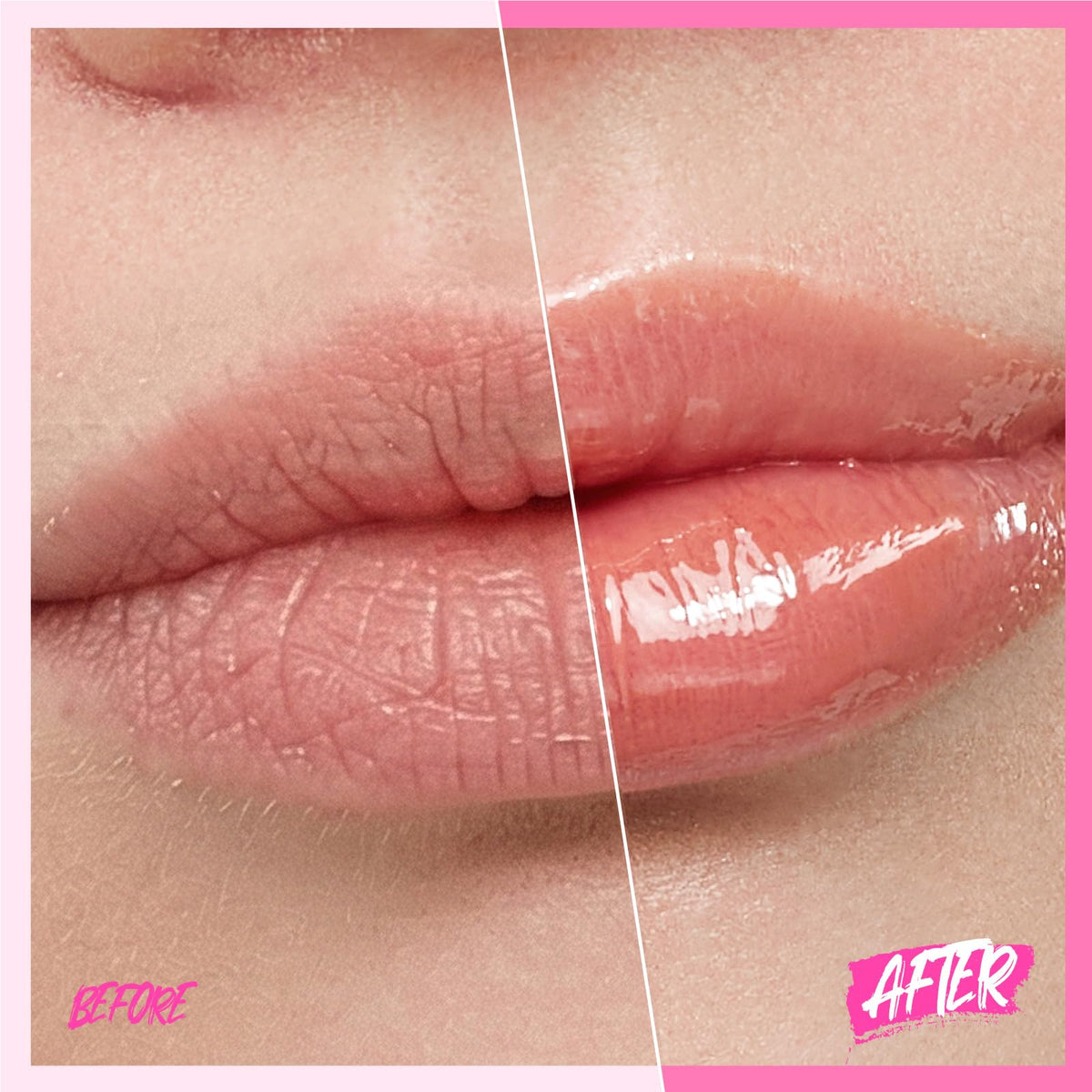 Close-up of SKINTIFIC Brightening Lip Serum applicator