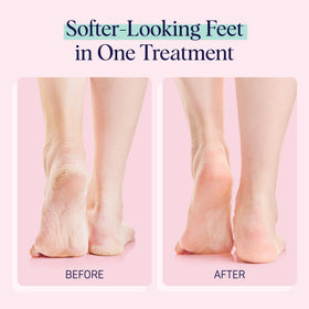 Close-up of SpaLife Moisturizing Foot Sockies texture