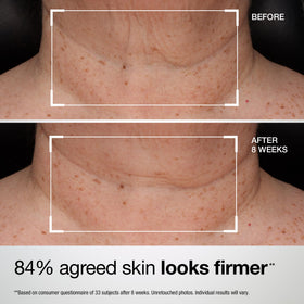 Close-up of StriVectin TL Advanced Tightening Neck & Chest Lotion SPF 35 texture