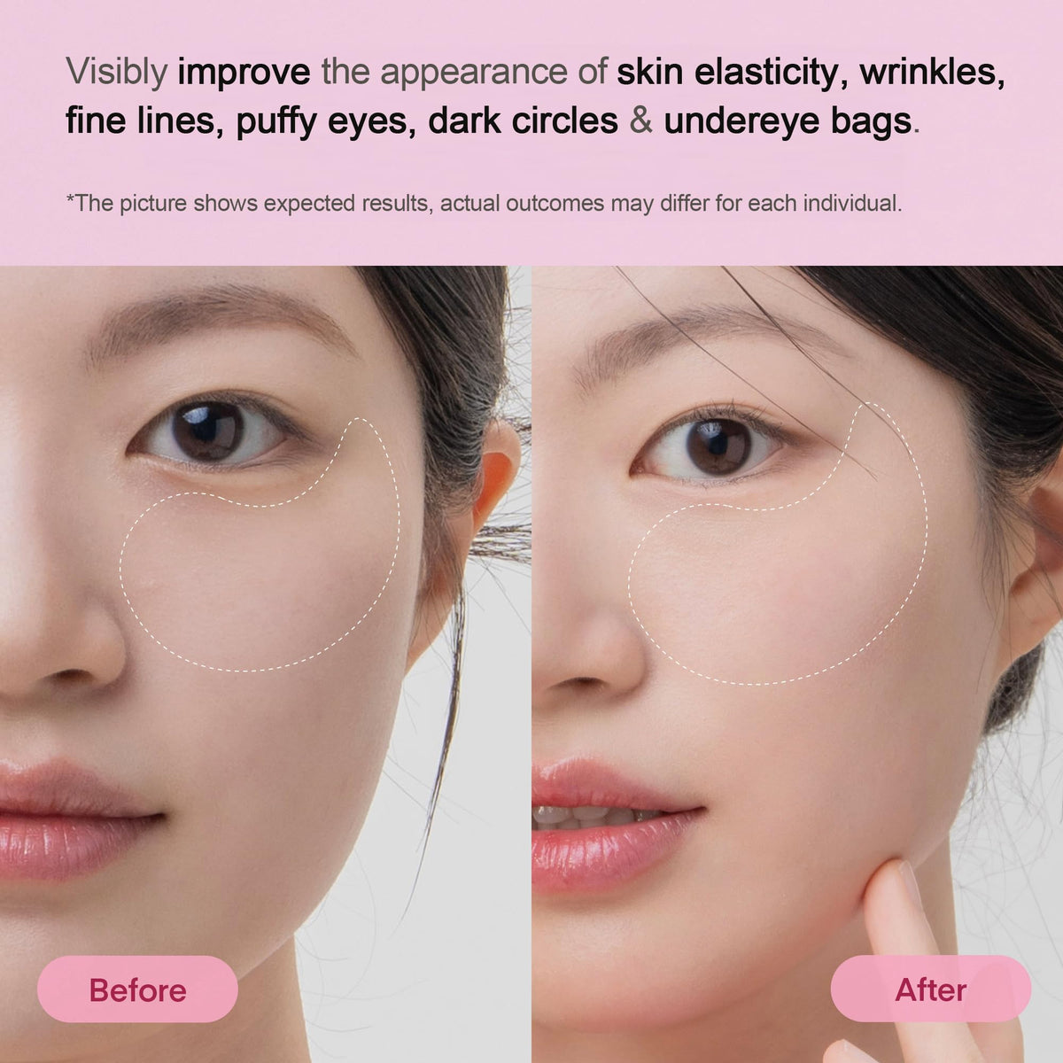 Close-up of TEREZ & HONOR hydrogel eye patch on model's under-eye