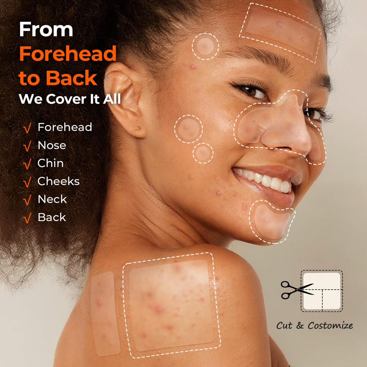 Close-up of TKTK Hydrocolloid Pimple Patches showing different sizes