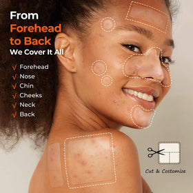 Close-up of TKTK Hydrocolloid Pimple Patches showing different sizes