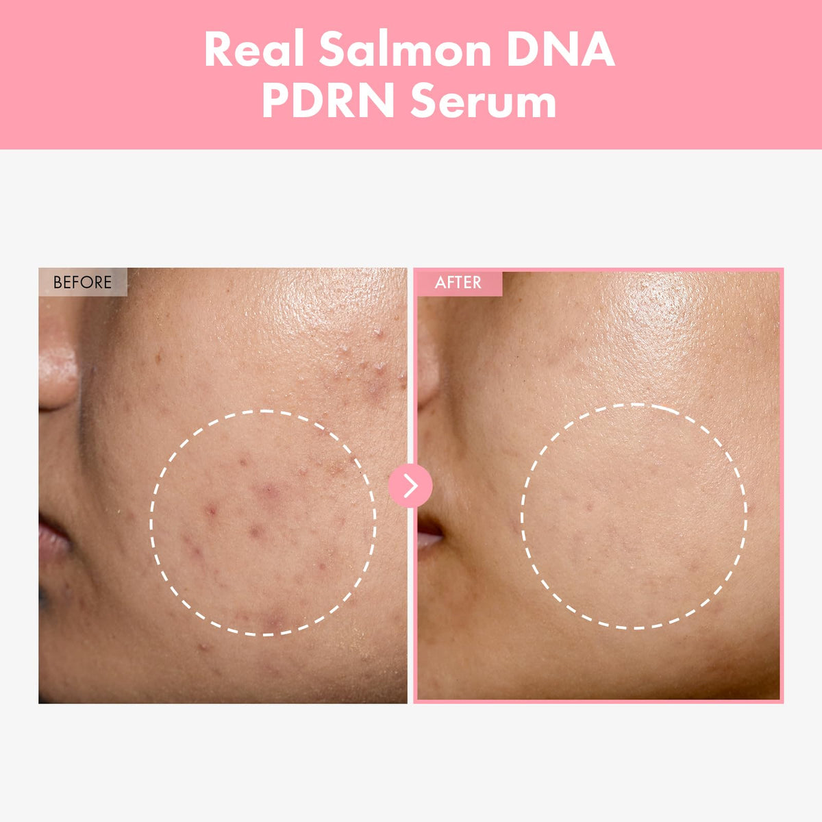 Close-up of TOSOWOONG Pink Peptide 12 PDRN Serum bottle