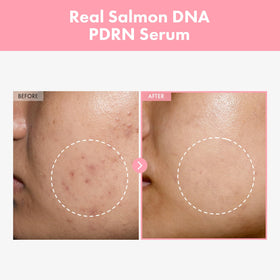 Close-up of TOSOWOONG Pink Peptide 12 PDRN Serum bottle