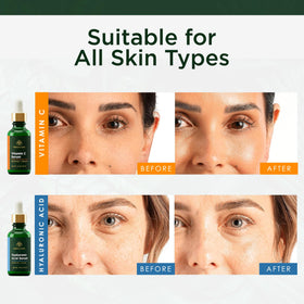 Close-up of Tree of Life Hyaluronic Acid serum bottle