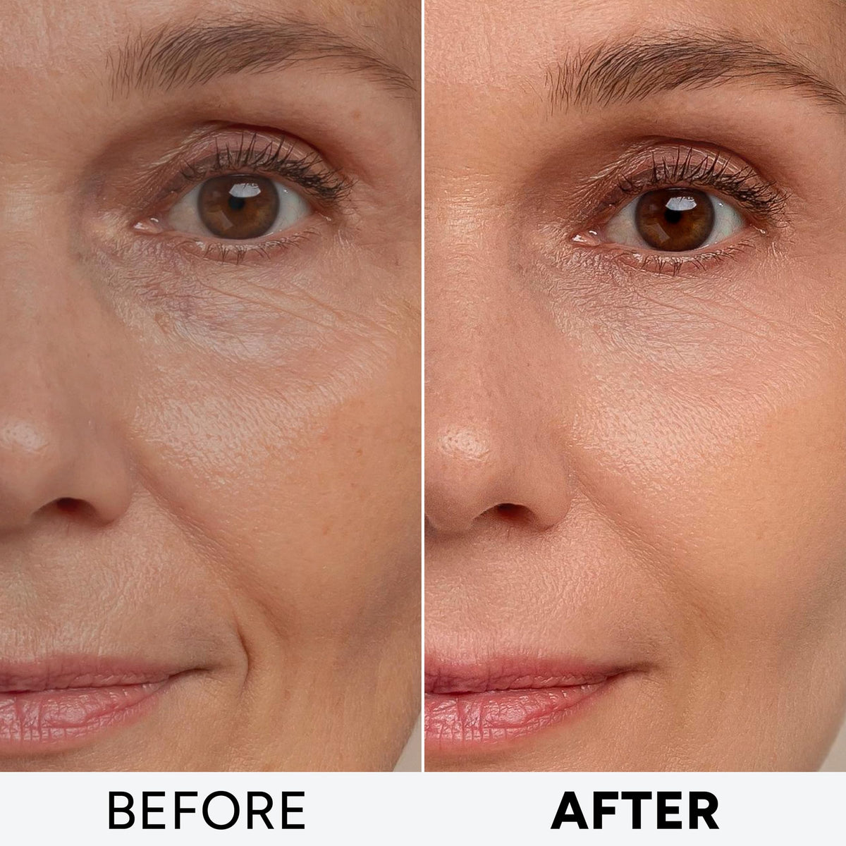 Collagen and Hyaluronic Acid ingredients list