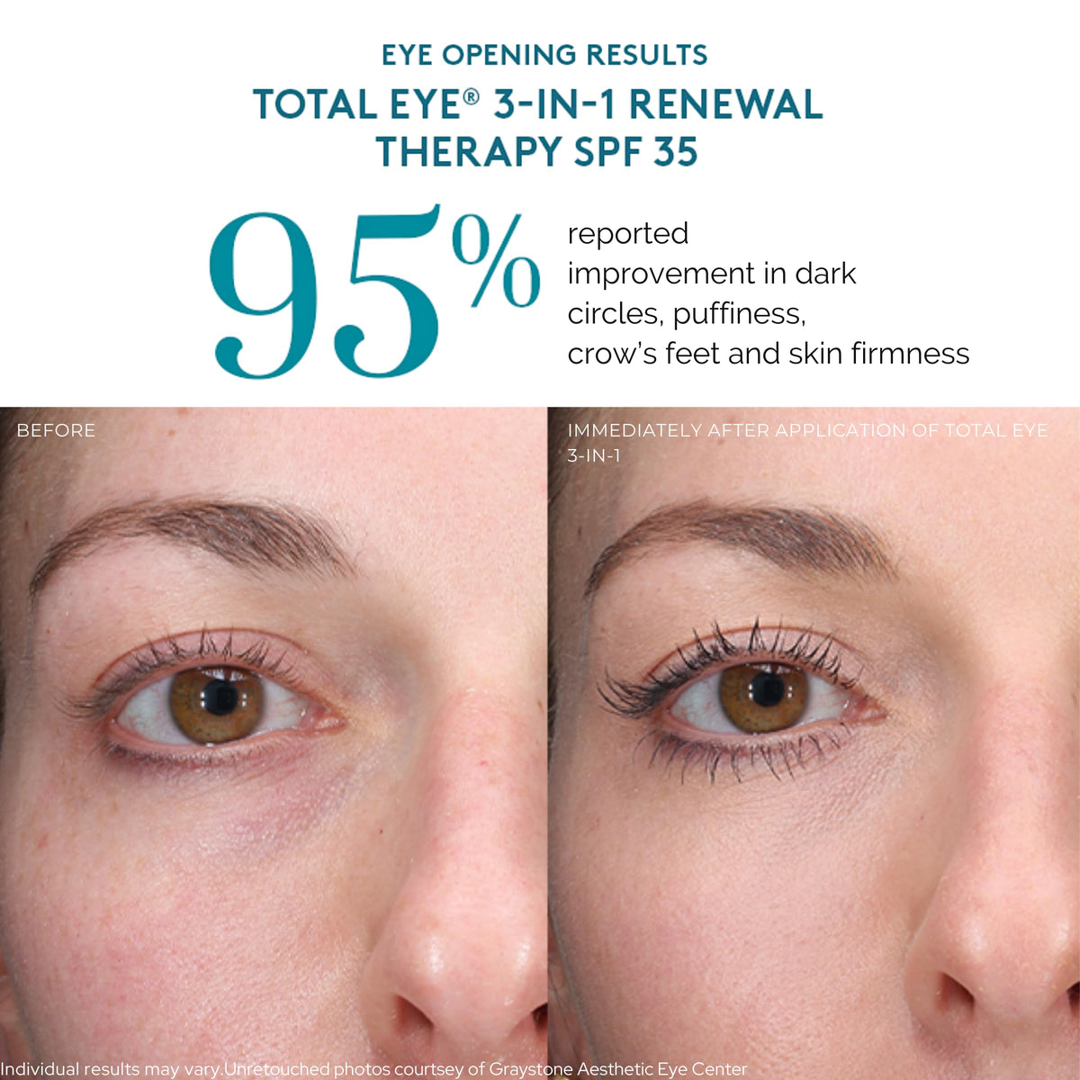 Colorescience Total Eye 3-in-1 Renewal Therapy SPF 35 Tan application demonstration