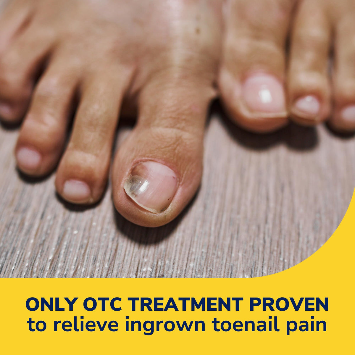 Contents of Dr. Scholl's Ingrown Toenail Kit including gel and tools