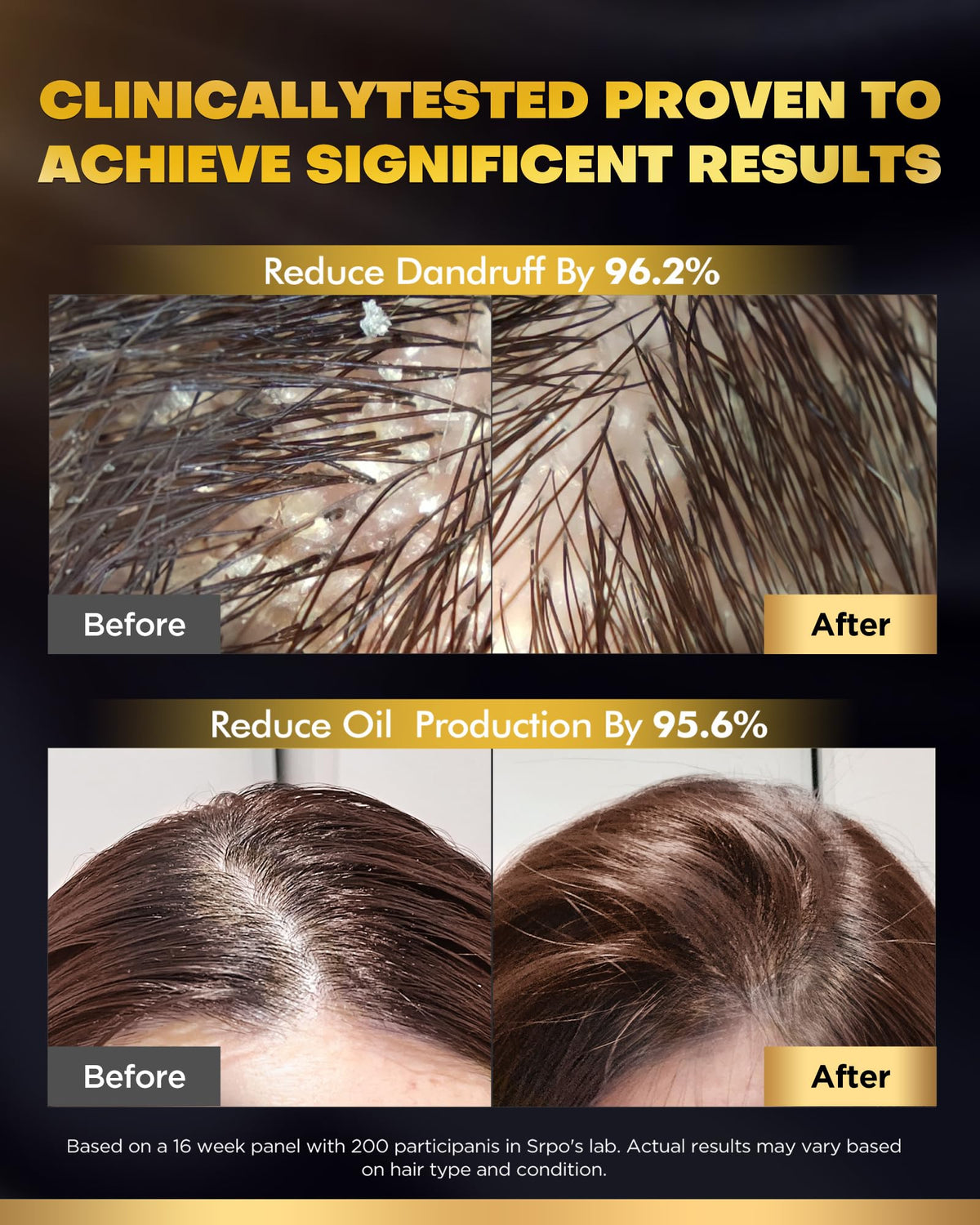 COOLKESI Biotin Shampoo lathering on hair