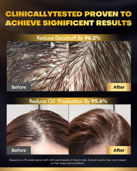 COOLKESI Biotin Shampoo lathering on hair