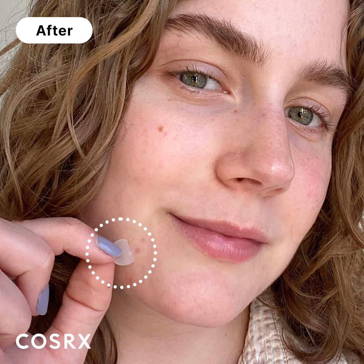 COSRX Acne Pimple Patches showing different sizes
