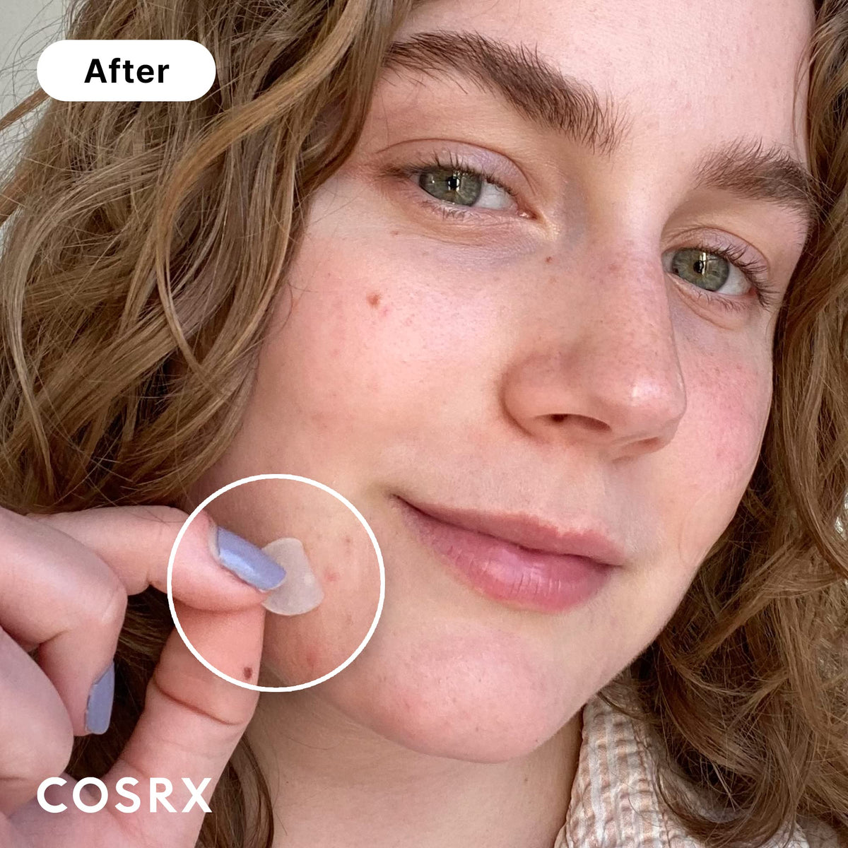 COSRX Acne Pimple Patches showing three sizes