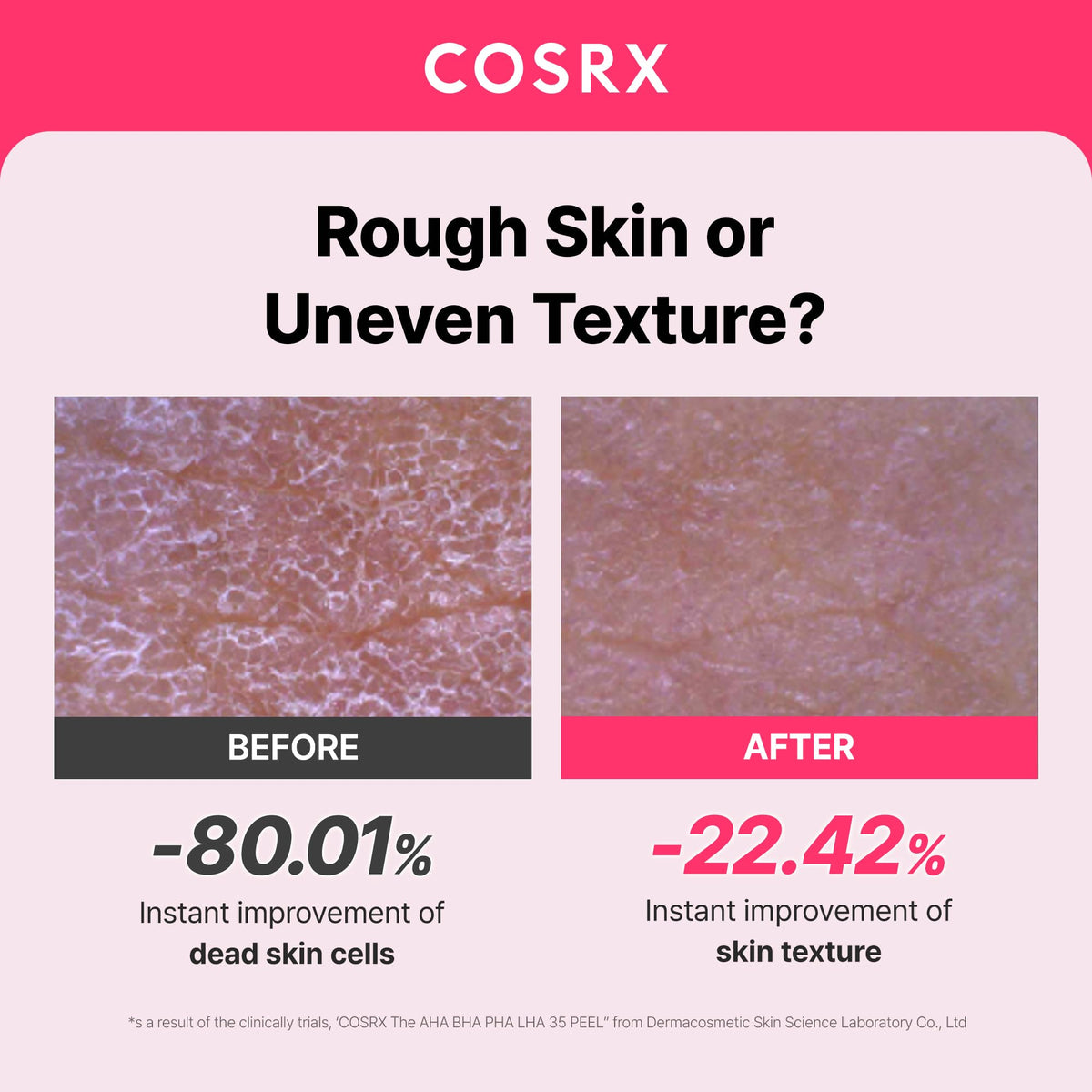 COSRX AHA BHA PHA LHA 35% Peel Exfoliating Gel texture close-up